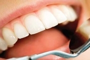 با این روش خانگی دندانتان را سفید کنید