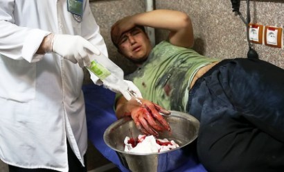 29 مصدوم حوادث چهارشنبه سوری از بیمارستان های ساوه ترخیص شدند