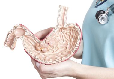 رابطه استرس و بیماری‌های گوارشی
