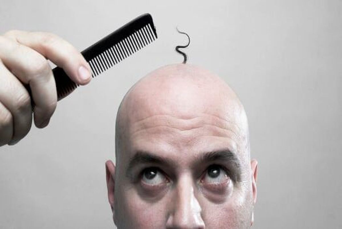 چه غذاهای از ریزش مو جلوگیری می کند؟