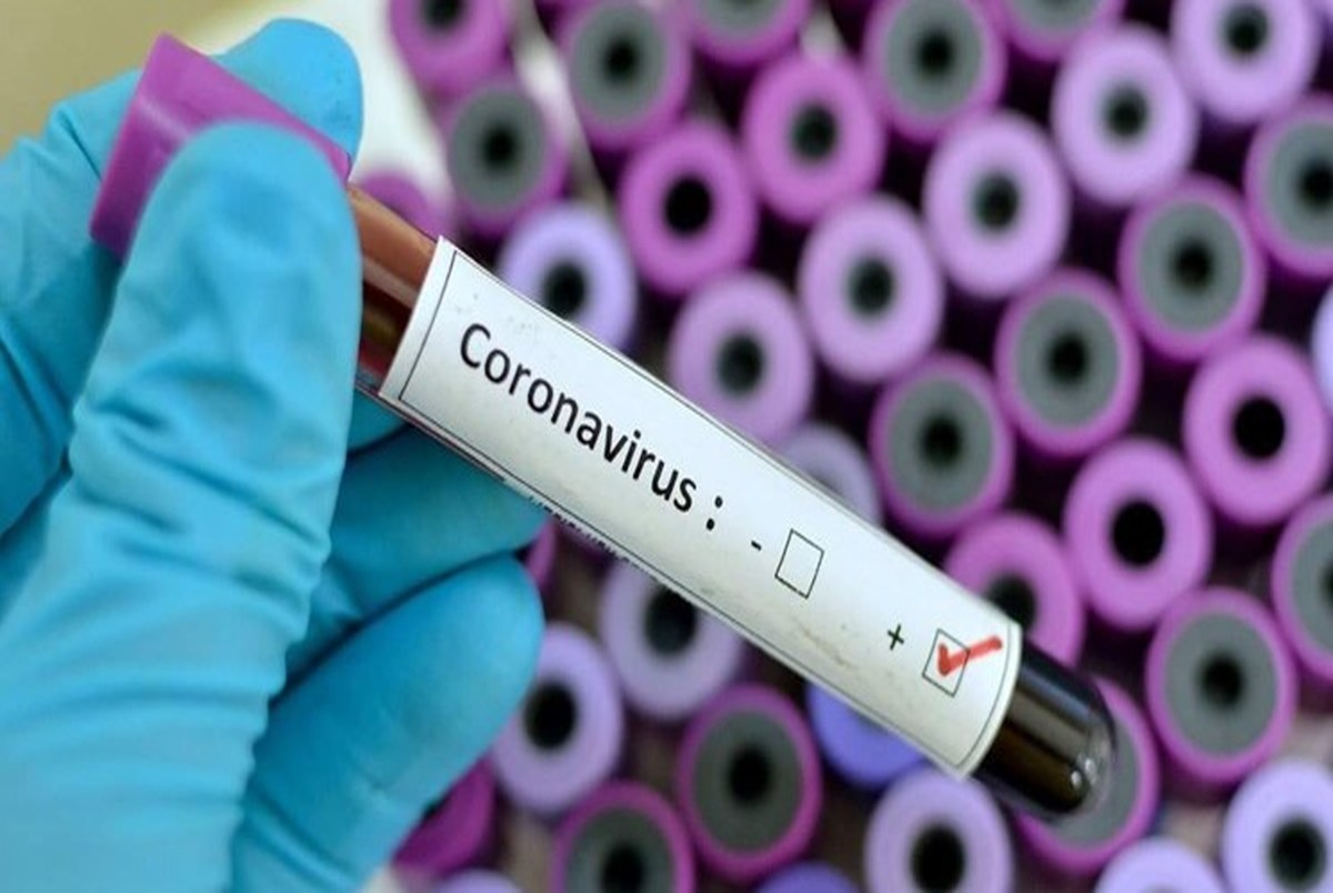  247 تن از مبتلایان به ویروس کرونا درمان شدند