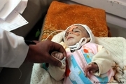 جنگ فراموش شده یمن: پای درد دل های تلخ قربانیان