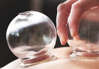 حجامت باعث لاغری و افزایش قد می‌شود؟
