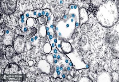 تحولی بزرگ در درمان کرونا؛ تولید پادتنی که مانع از ورود کرونا به سلول‌ ها می ‌شود
