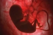 چهار فاکتوری که ریسک سقط جنین را افزایش می دهد