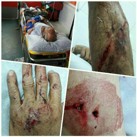حمله پلنگ به یک روستایی در خلخال وی را راهی بیمارستان کرد