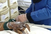 انفجار ترقه، نوجوان 14 ساله شیرازی را زخمی کرد