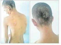 گزارشی دردناک از ضرب و شتم یک معلول توسط پرسنل توانبشخی استان کهگیلویه و بویر احمد