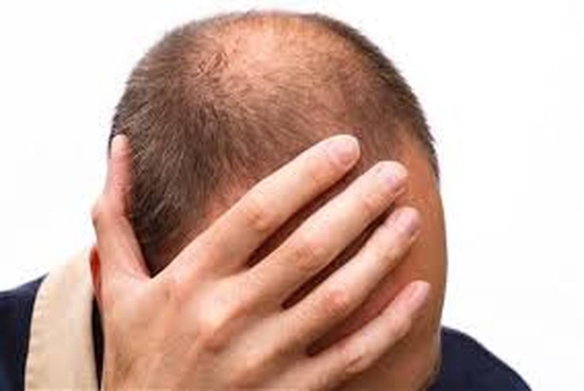 8 درمان طبیعی برای مقابله با نازکی مو