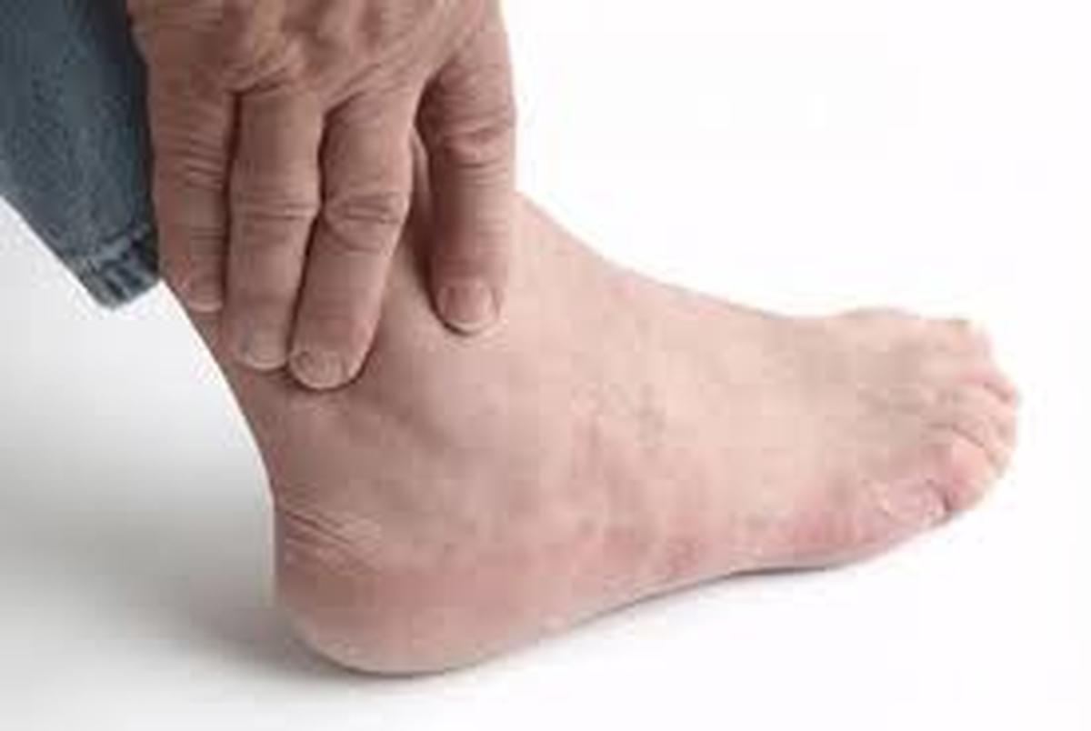 نشانه های آتروز پا را بشناسید