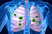 روشی جدید برای تشخیص بیماری‌های ریه