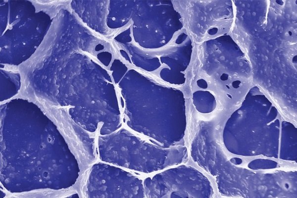 این ژل از بازگشت سرطان جلوگیری می کند