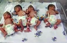 تولد چهارقلوهای لنگرودی در بیمارستان الزهرا رشت