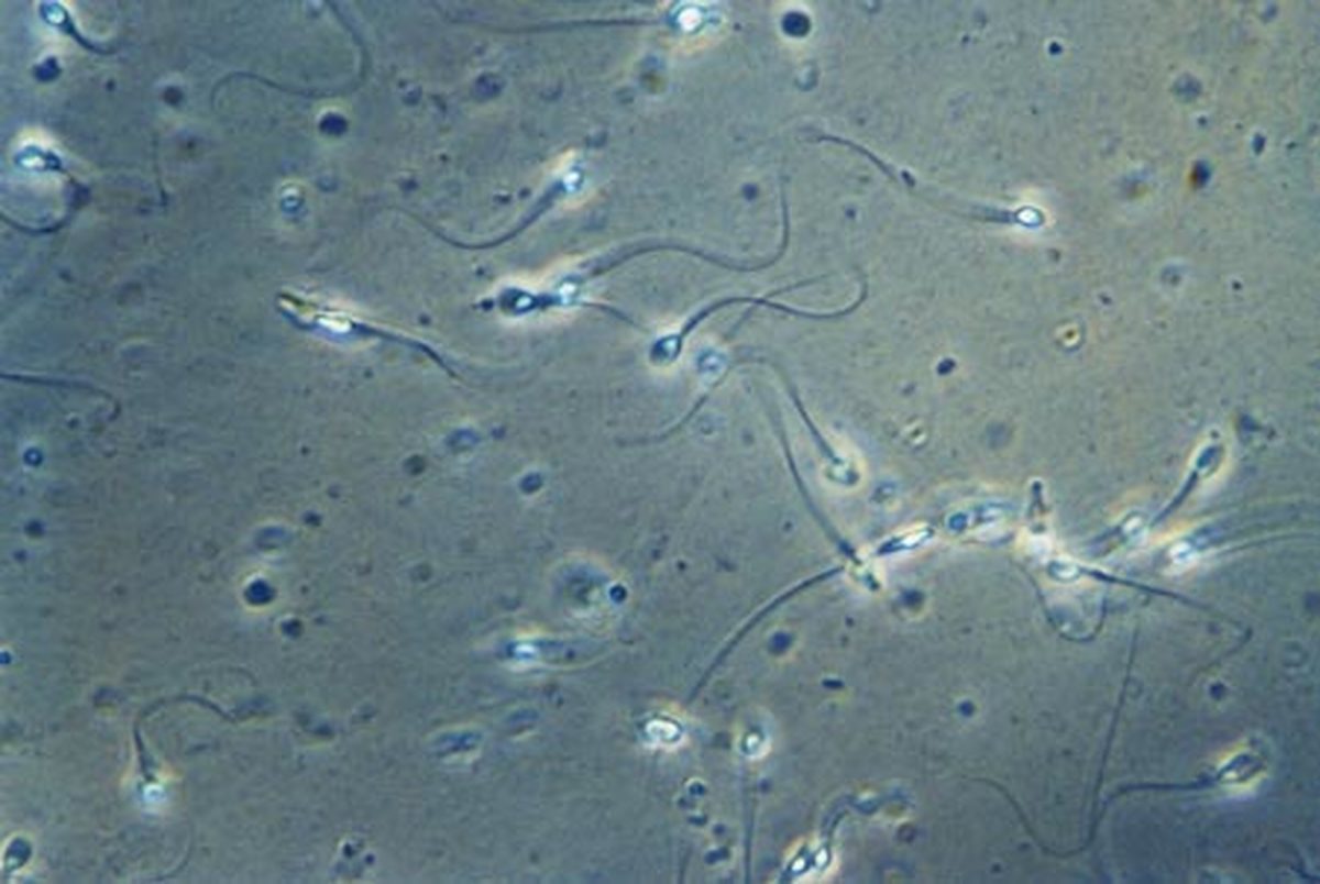 اسپرم ها حامل موثر داروهای ضدسرطانی!