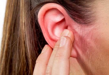 علت خشک شدن پوست گوش چیست؟
