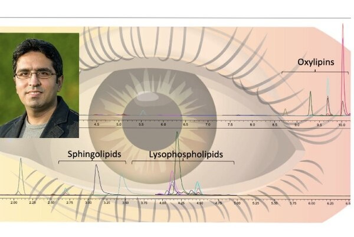 ابداع روشی برای تشخیص بیماری های چشمی توسط دانشمندان ایرانی 