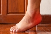 این علائم در پاها نشانه بیماری خطرناکی است