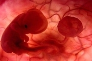 جنین‌ها با روش IVF بیشتر دختر می‌شوند یا پسر؟ 