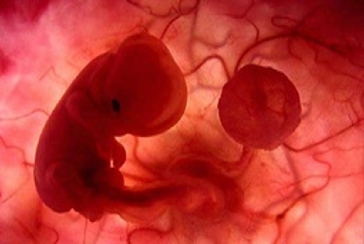 جنین‌ها با روش IVF بیشتر دختر می‌شوند یا پسر؟ 