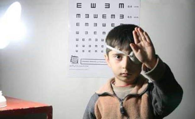 طرح غربالگری بینایی چشم کودکان سه تا 6 سال در روستاها رایگان است